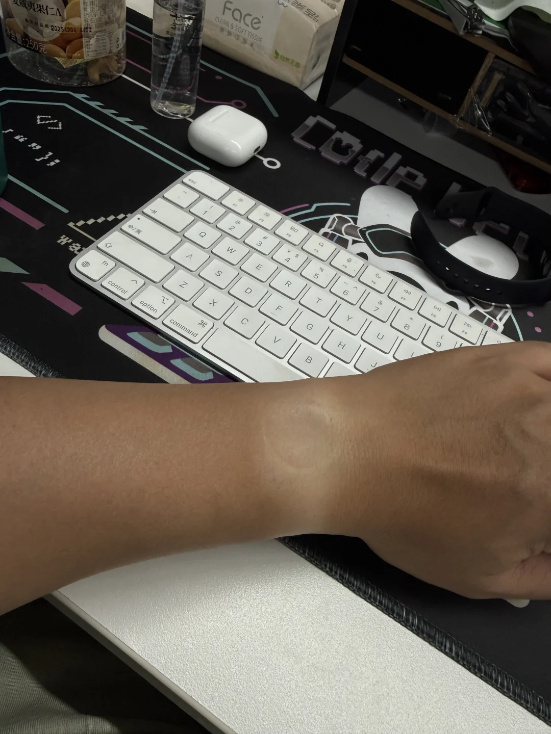 再见,5年老伙计Watch SE!换新款了 再见,5年老伙计Watch SE!换新款了